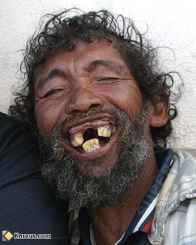 ooooooooo bien fé la position des dents